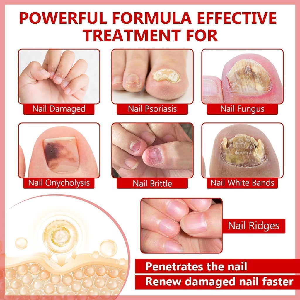 toenail-fungus-treatment-extra-strength--3.jpg