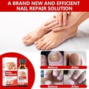 toenail-fungus-treatment-extra-strength--5.jpg