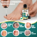 flobow-toe-nail-fungus-treatments-toenai-6.jpg