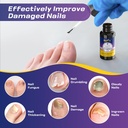 toenail-fungus-treatment-extra-strength--4.jpg