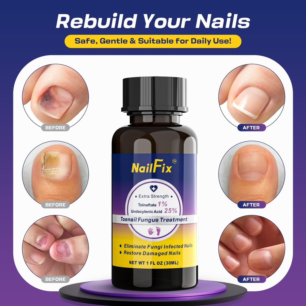 toenail-fungus-treatment-extra-strength--2.jpg
