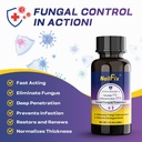 toenail-fungus-treatment-extra-strength--5.jpg