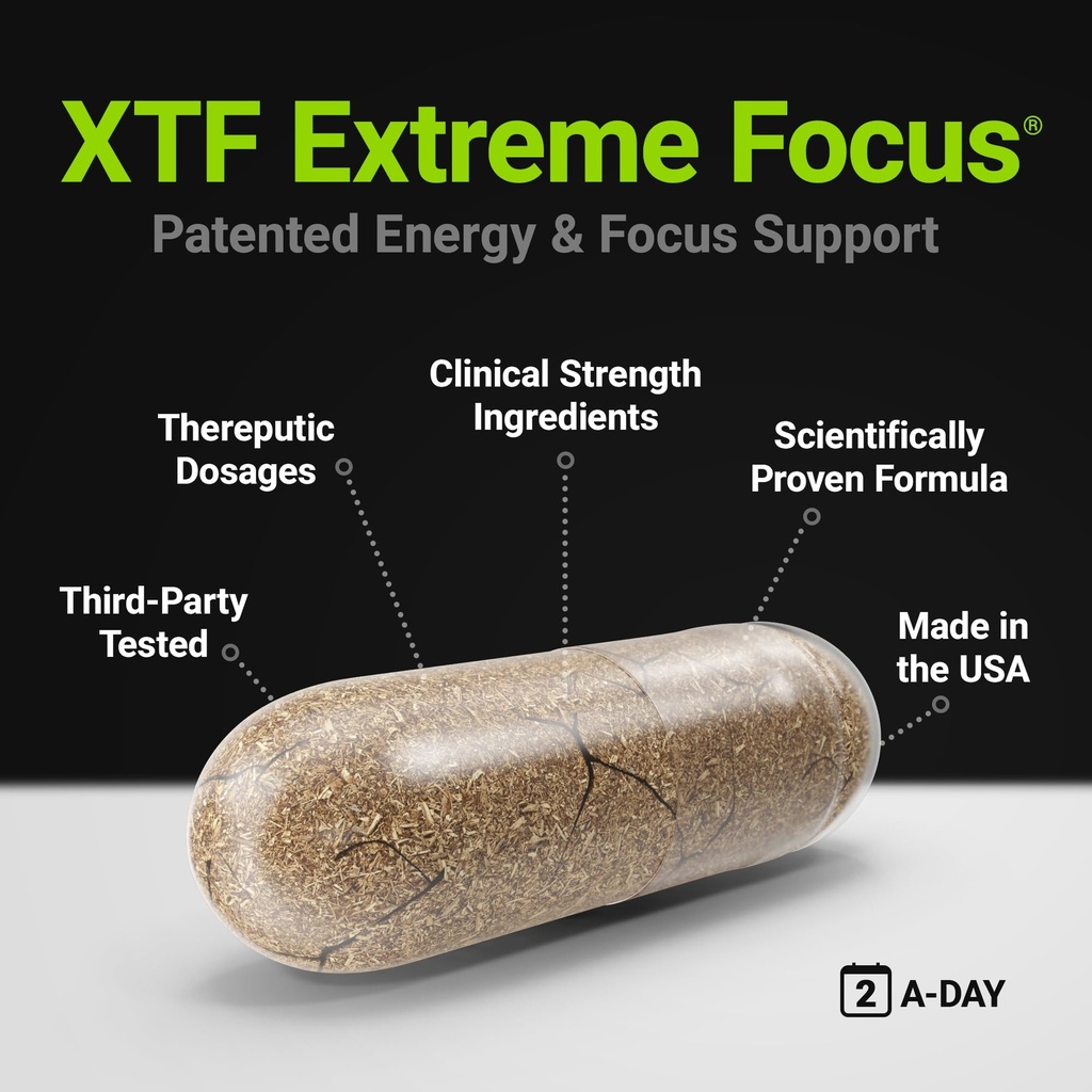 procera-xtf-perfect-study-aid-immediate--4.jpg