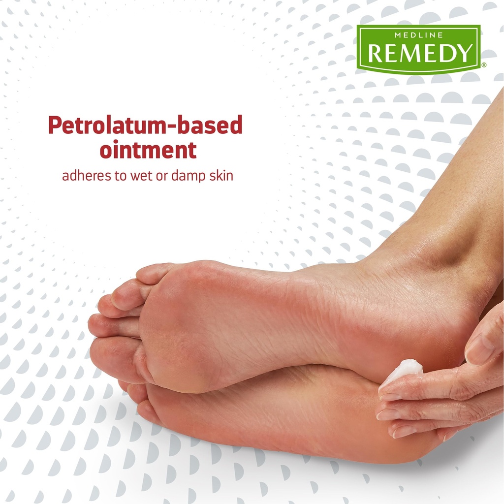 medline-remedy-clinical-antifungal-ointm-6.jpg