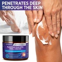 plantar-fasciitis-relief-cream-heel-disc-5.jpg
