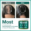 revive-hair-gummies-sea-moss-gummies-wit-3.jpg