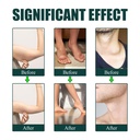 lymphatic-drainage-drops-lymphatic-suppo-4.jpg