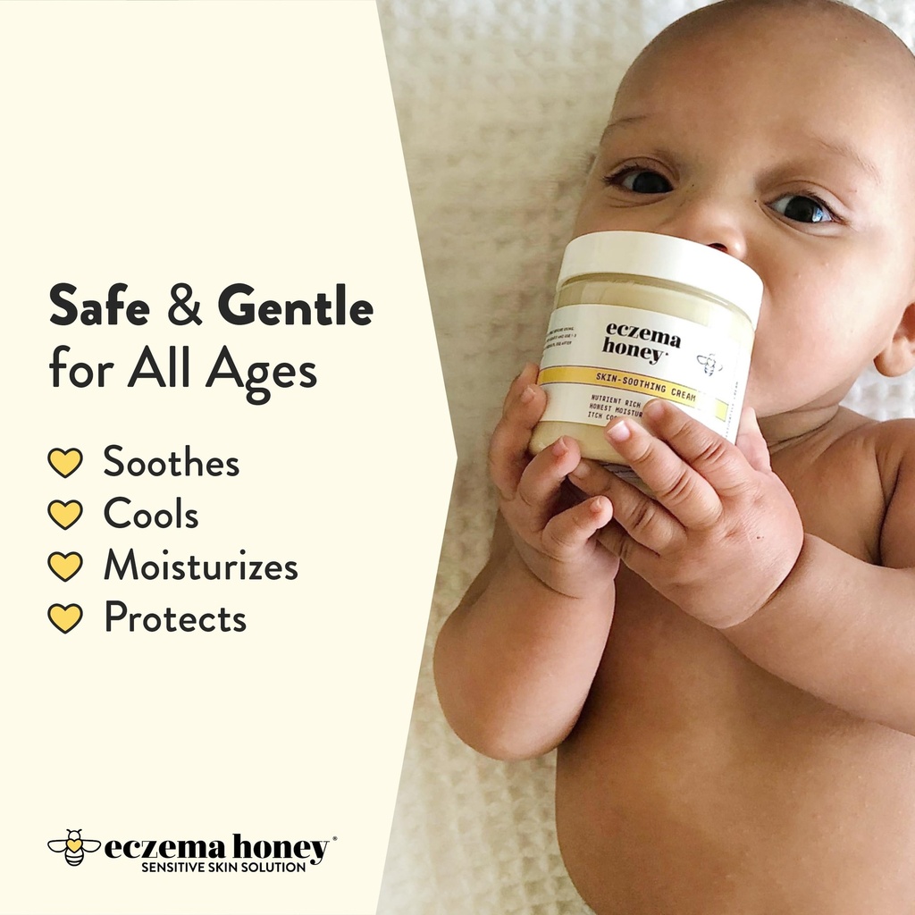 eczema-honey-original-skin-soothing-crea-3.jpg