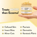 eczema-honey-original-skin-soothing-crea-5.jpg