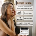 healfast-the-original-scar-cream-for-str-2.jpg