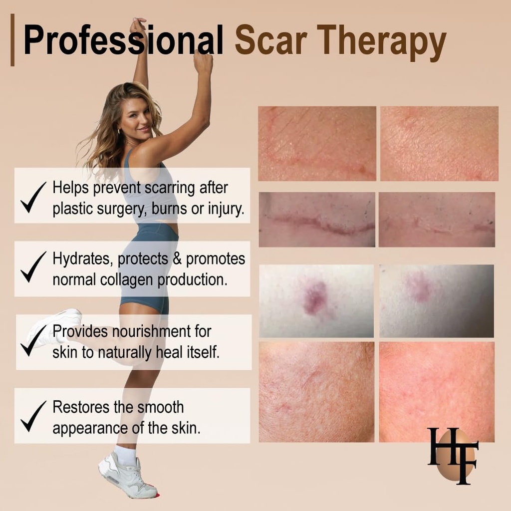 healfast-the-original-scar-cream-for-str-4.jpg