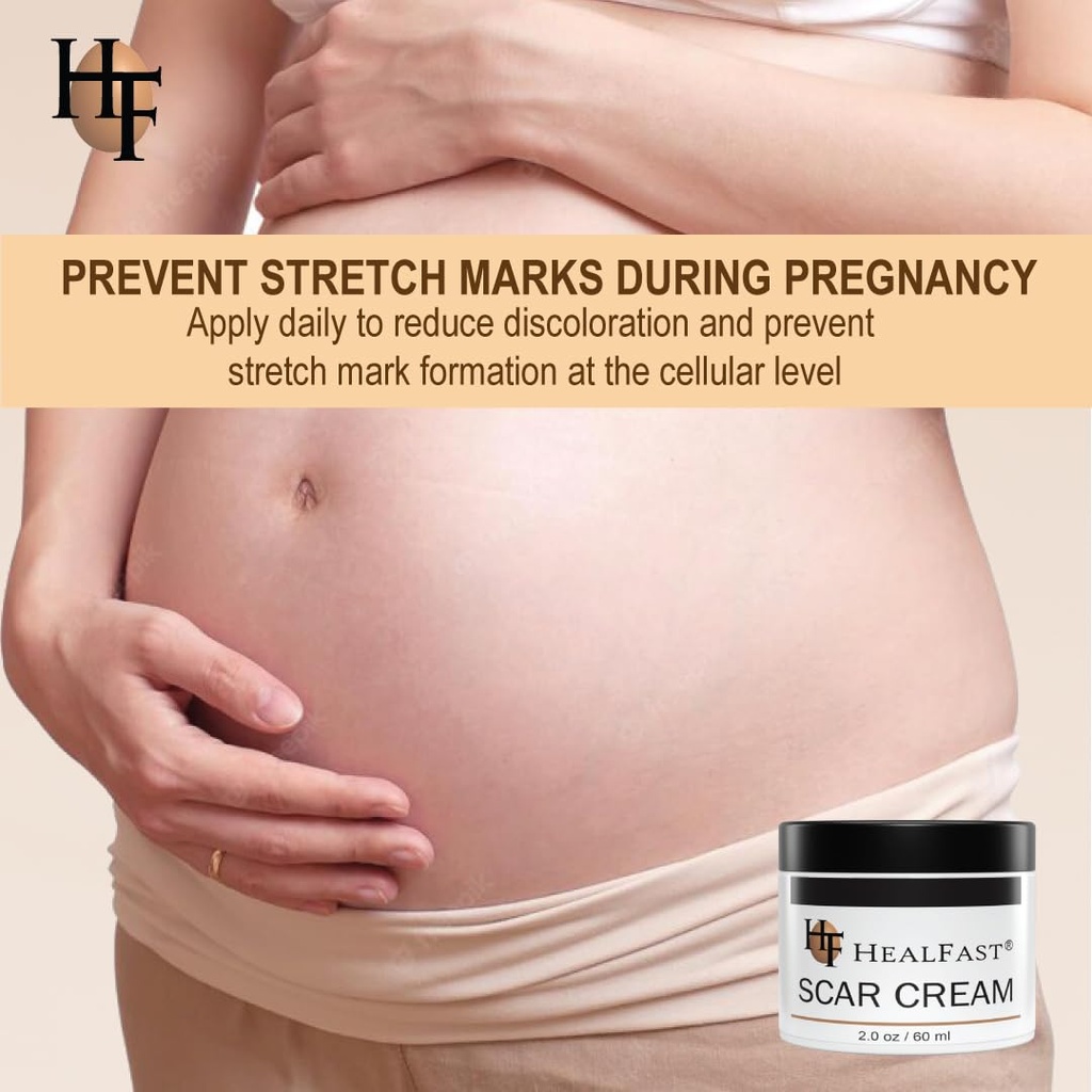 healfast-the-original-scar-cream-for-str-6.jpg