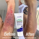 triderma-intense-fast-skin-healing-cream-2.jpg