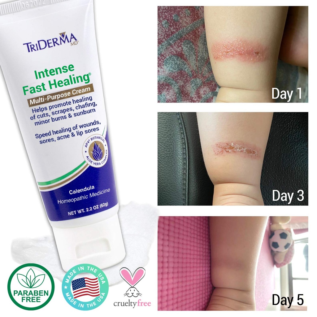 triderma-intense-fast-skin-healing-cream-6.jpg