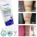triderma-intense-fast-skin-healing-cream-6.jpg