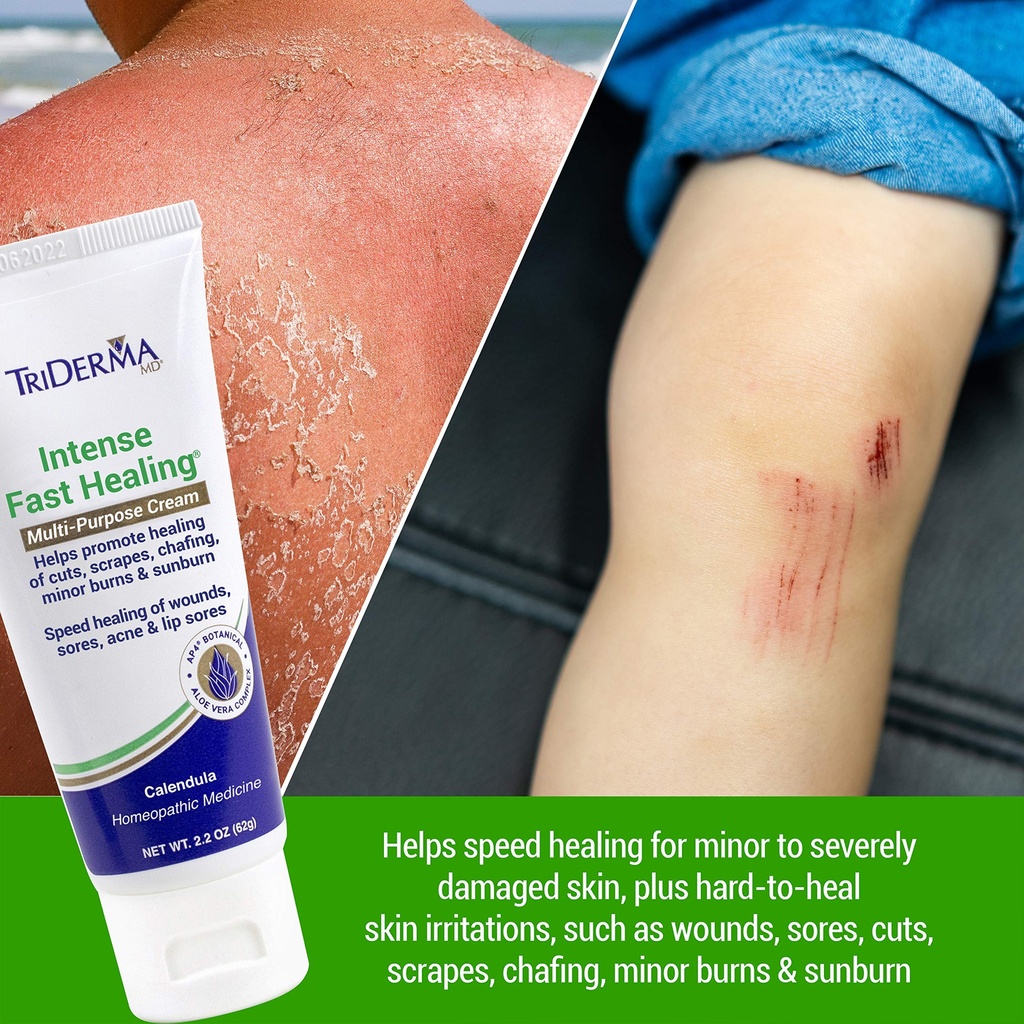 triderma-intense-fast-skin-healing-cream-3.jpg