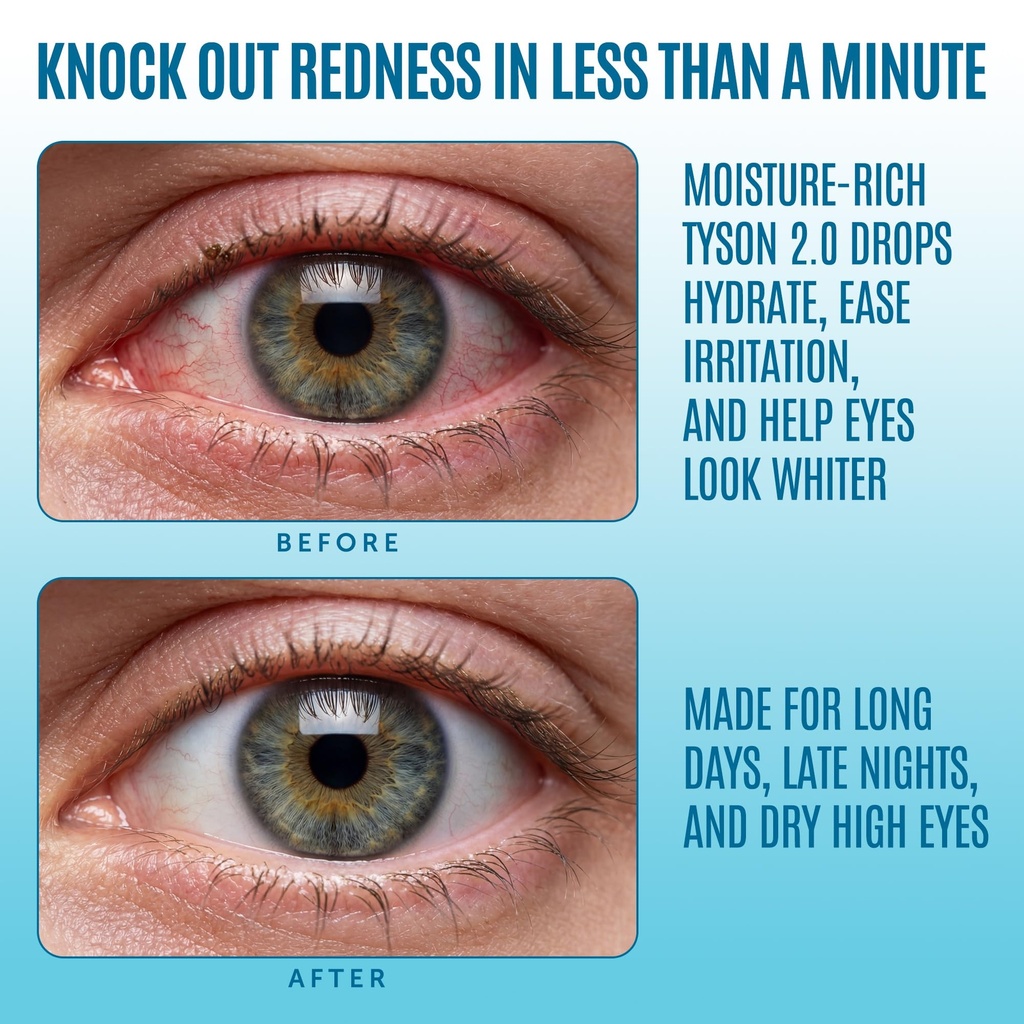 tyson-2-0-mike-red-eye-drops-max-strengt-3.jpg