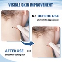 molluscum-support-treatment-molluscum-su-3.jpg