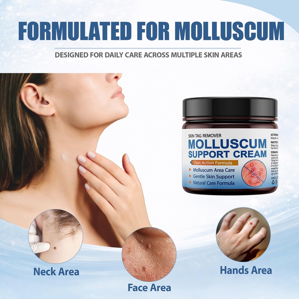 molluscum-support-treatment-molluscum-su-2.jpg
