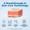 vitamedica-scar-gel-peptides-medical-gra-5.jpg
