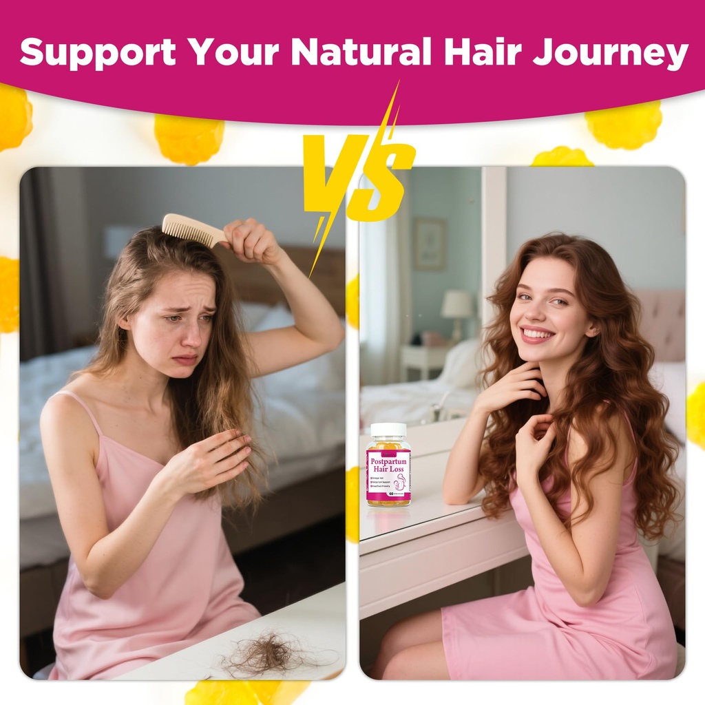 aromlife-postpartum-hair-loss-gummies-fo-5.jpg