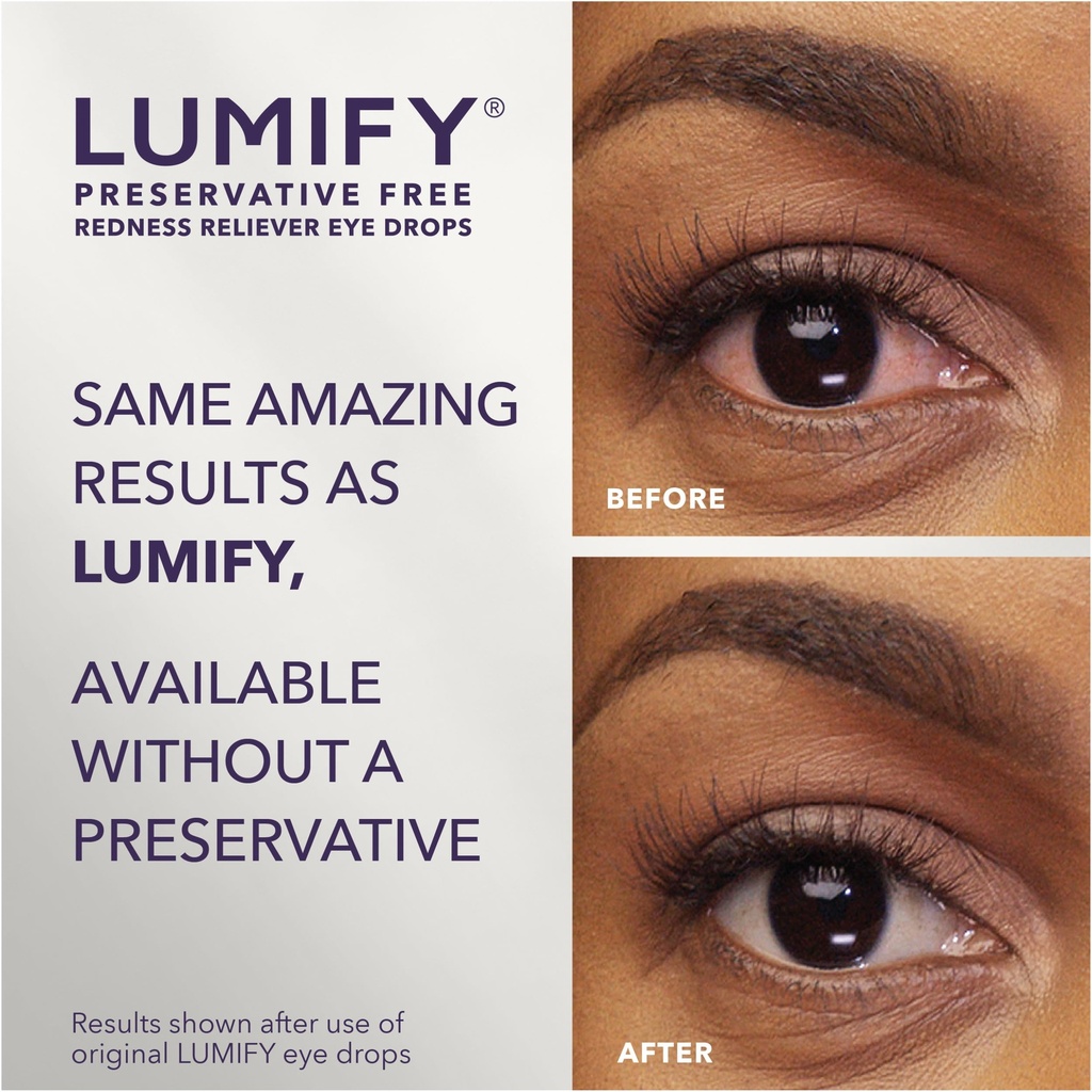 lumify-preservative-free-eye-drops-for-r-2.jpg