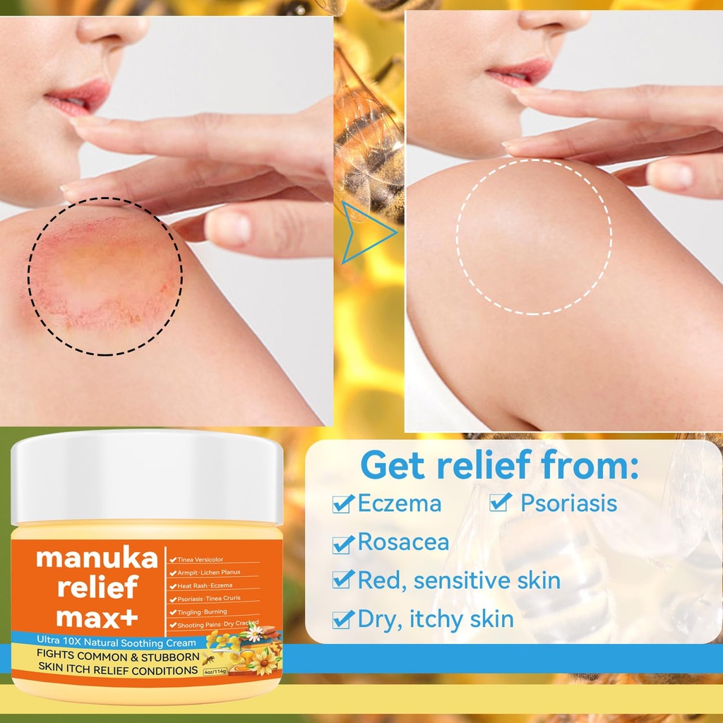 manuka-honey-cream-max-strength-treat-na-4.jpg