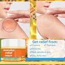 manuka-honey-cream-max-strength-treat-na-4.jpg