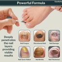anti-fungal-foot-finger-nails-fungus-tre-3.jpg