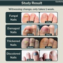 anti-fungal-foot-finger-nails-fungus-tre-2.jpg