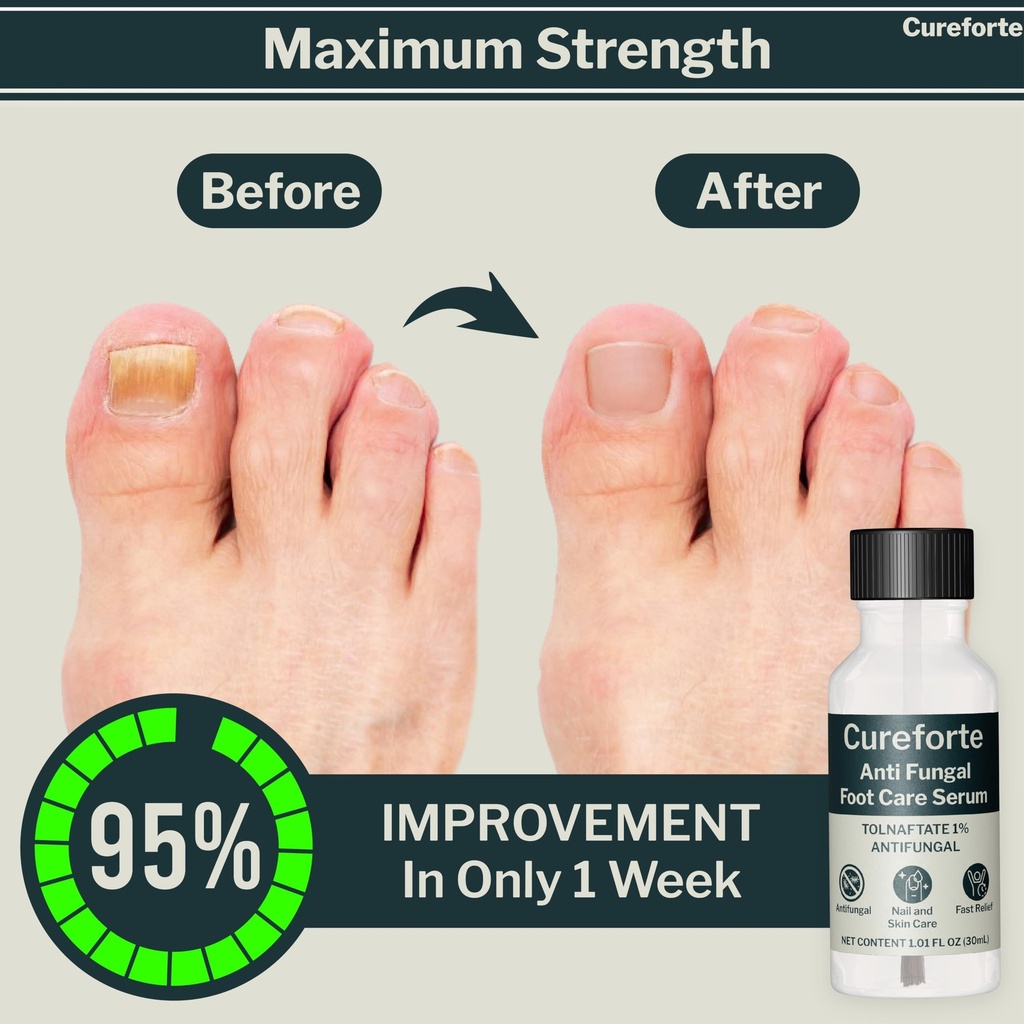 anti-fungal-foot-finger-nails-fungus-tre-5.jpg