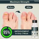 anti-fungal-foot-finger-nails-fungus-tre-5.jpg