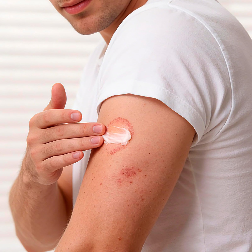 antifungal-cream-for-athlete-s-foot-jock-6.jpg