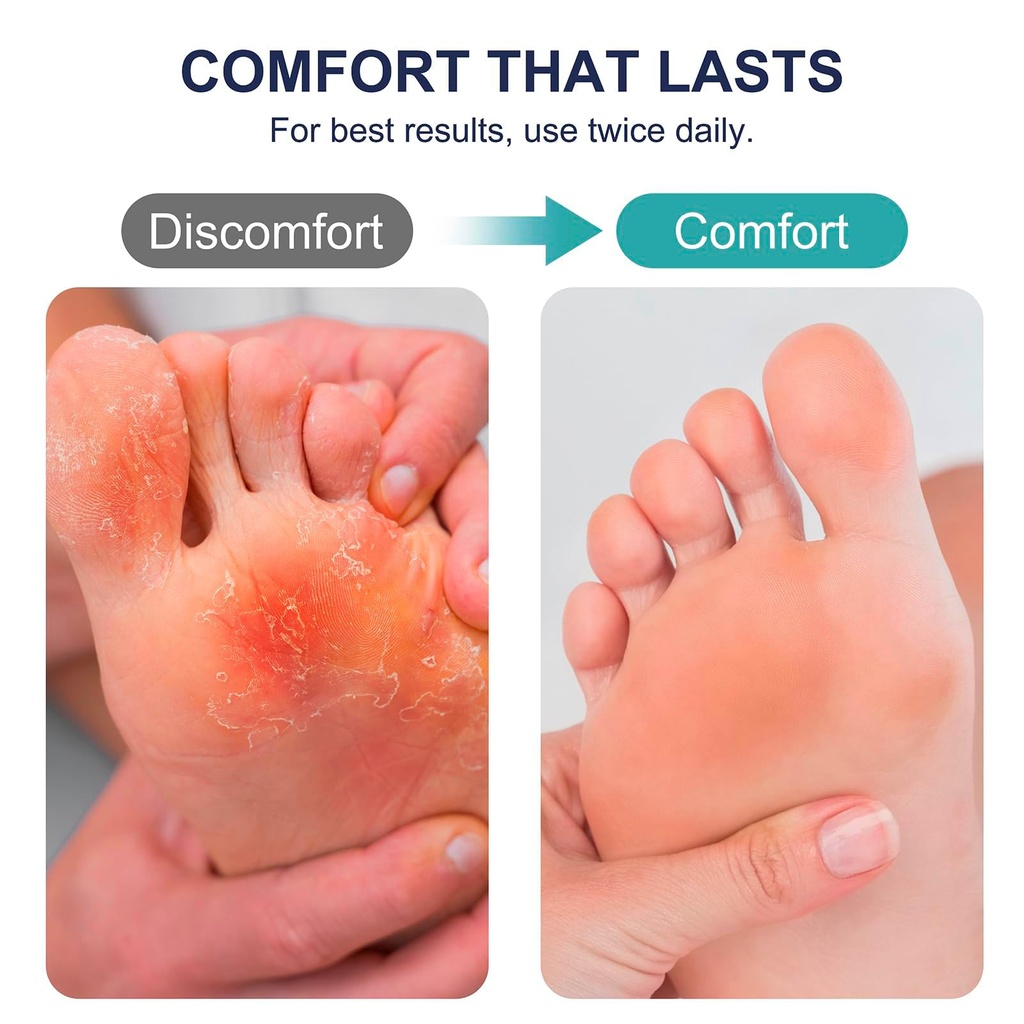antifungal-cream-for-athlete-s-foot-jock-4.jpg