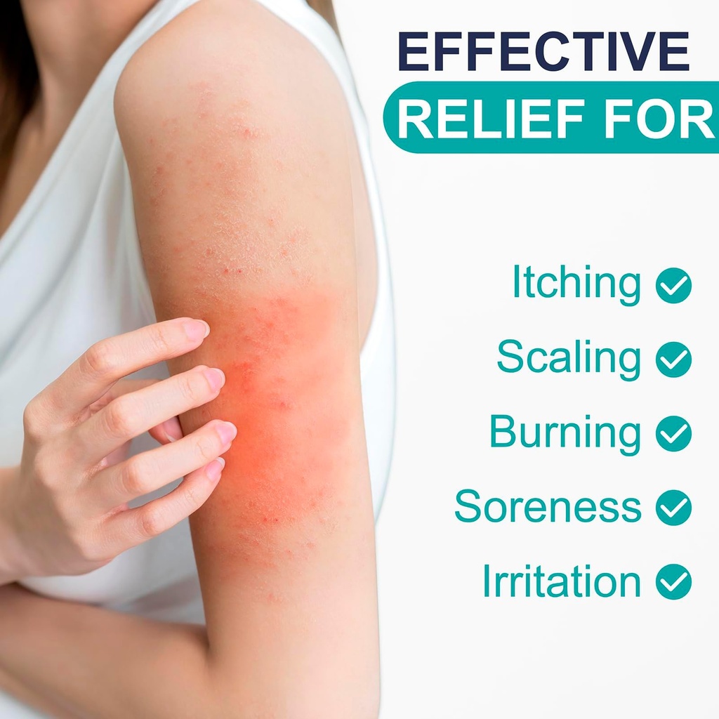 antifungal-cream-for-athlete-s-foot-jock-3.jpg