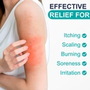 antifungal-cream-for-athlete-s-foot-jock-3.jpg