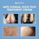 hermon-jock-itch-antifungal-cream-ringwo-6.jpg