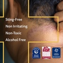 a-d-advanced-dermatitis-care-hydrogel-sp-6.jpg