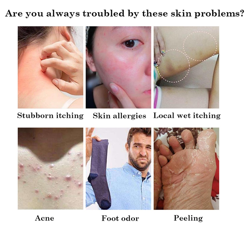 5pcs-chinese-herbal-eczema-psoriasis-cre-5.jpg