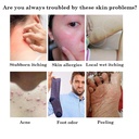 5pcs-chinese-herbal-eczema-psoriasis-cre-5.jpg
