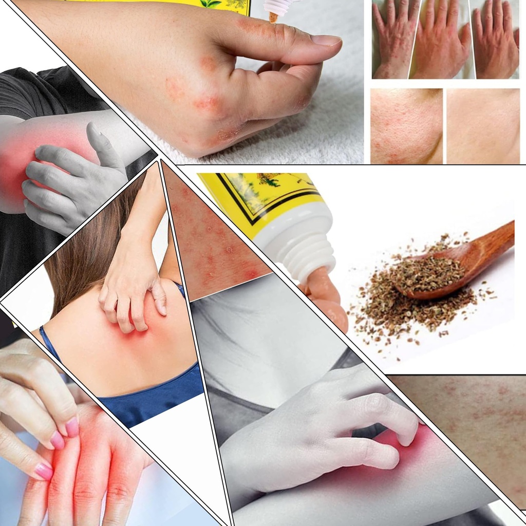 5pcs-chinese-herbal-eczema-psoriasis-cre-4.jpg