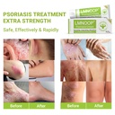 psoriasis-cream-maximum-strength-treatme-5.jpg