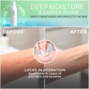 soraresal-psoriasis-cream-comfort-remedy-5.jpg