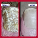 emuaidmax-homeopathic-psoriasis-scalp-tr-3.jpg