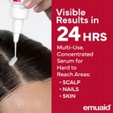 emuaidmax-homeopathic-psoriasis-scalp-tr-2.jpg