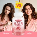 hair-growth-gummies-for-women-hair-skin--3.jpg