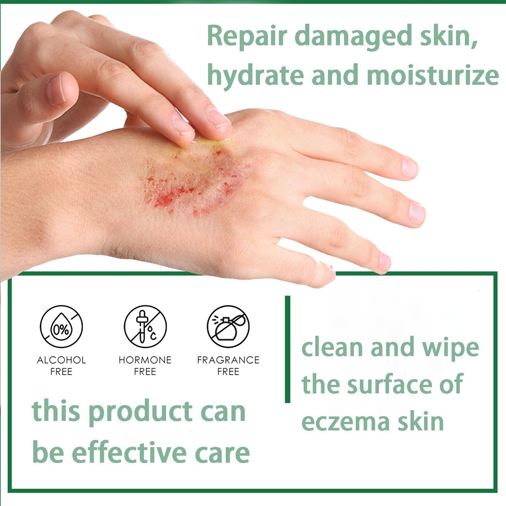 aacnre-ecz-ma-th-apy-spray-effective-7-d-3.jpg