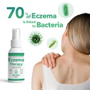 ququ-skin-hocl-acid-eczema-spray-instant-2.jpg