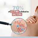 noveha-eczema-relief-soothing-hypochloro-5.jpg