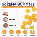 sugar-free-eczema-treatment-gummies-usa--3.jpg